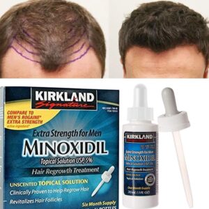 minoxidil-shop-ebay-pharmacy
